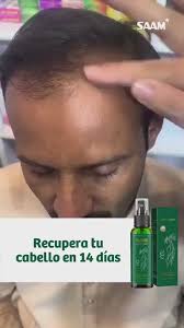 OUHOE -CRECIMIENTO DE CABELLO