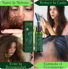 OUHOE -CRECIMIENTO DE CABELLO