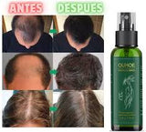 OUHOE -CRECIMIENTO DE CABELLO